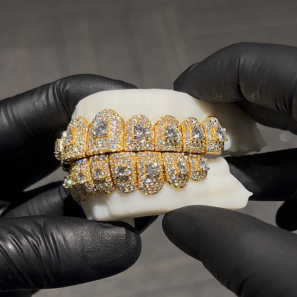 Custom Grillz — Fully Iced Moissanite, Raised Center Stone, Silver — NOVAE ATELIER